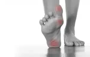 kaki kesemutan sebelah