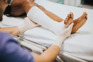 patah tulang kaki