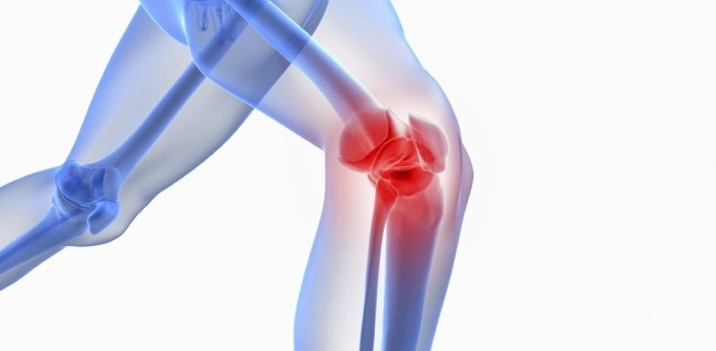 Gejala Osteoartritis Lutut yang Harus di waspadai