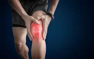 Ruam Merah di Sekitar Lutut - Patella