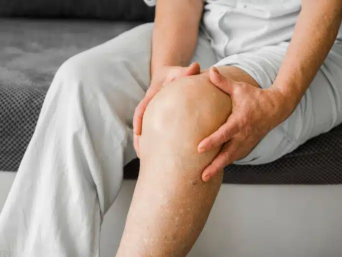 gout-arthritis-patella.id