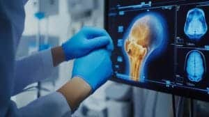 osteochondral autograft transplantation