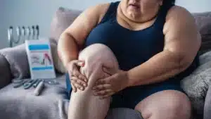 hubungan obesitas dengan osteoarthritis