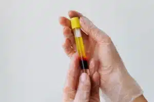 secretome vs stem cell