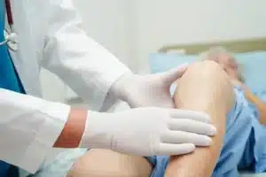 allogenic stem cells