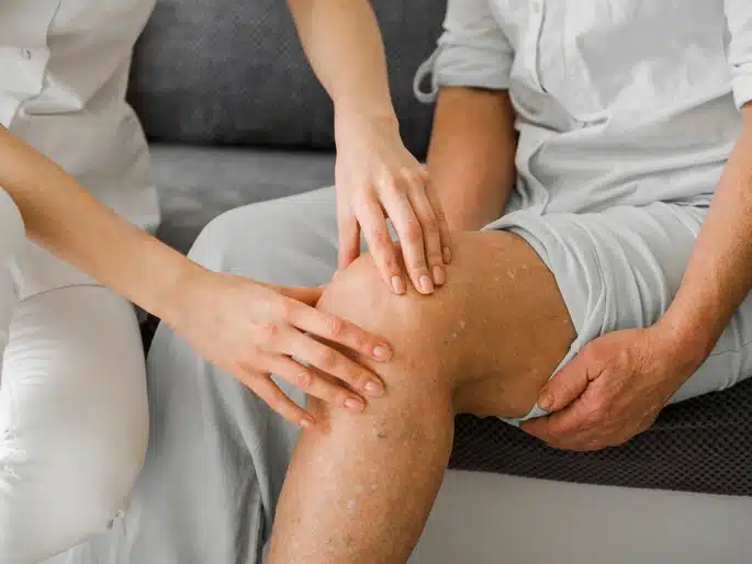 ligamen lutut - patella.id